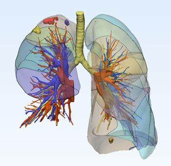 肺结节三维重建